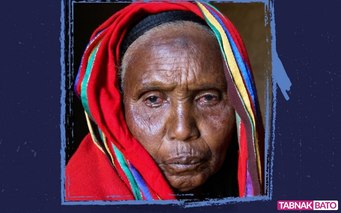 انتشار بیماری مرموز و کشنده در اتیوپی+تصاویر